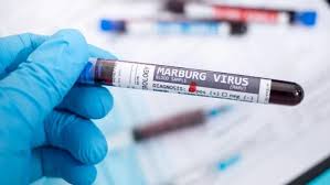 Tanzania Denies Alleged Marburg Outbreak After WHO Report